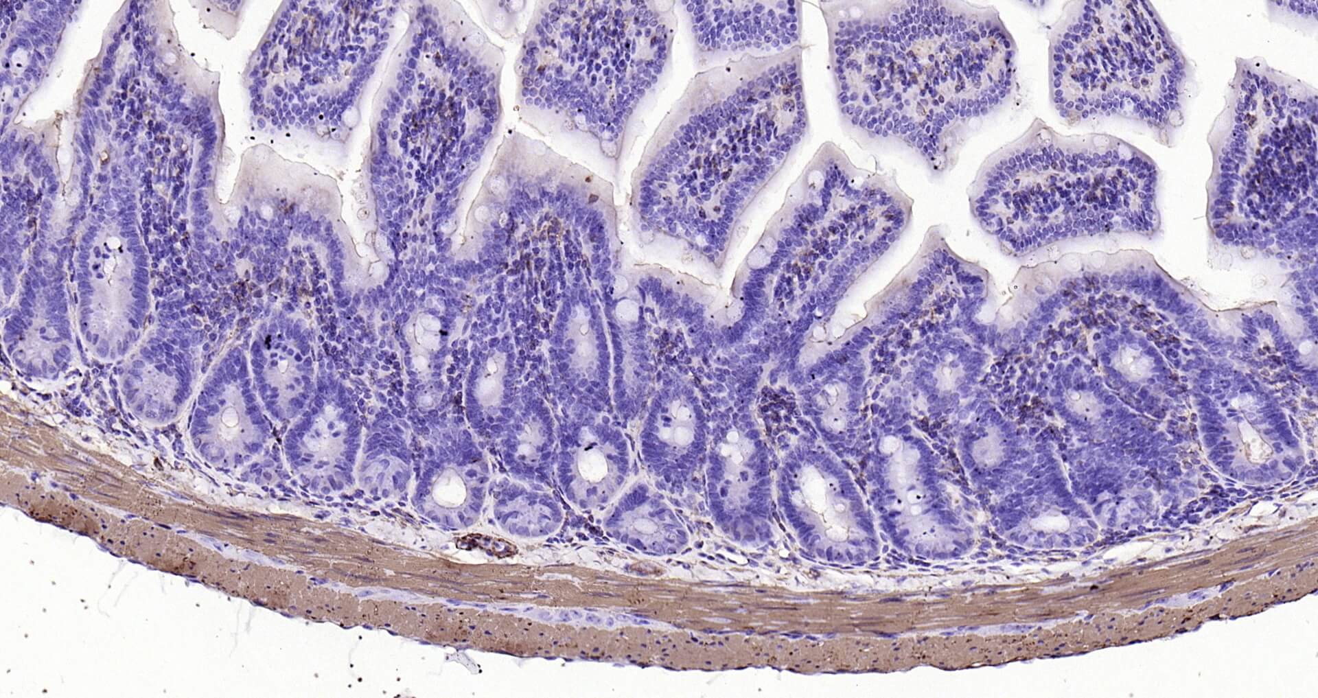 肌动蛋白α/α-SMA/α Actin单克隆即用型免疫组化试剂盒-IHC0114